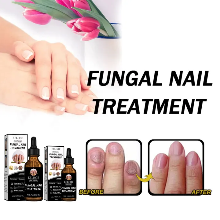 eelhoe-nail-repair-solution-thickening-and-brightening-nails-removing-gray-nails-dead-skin-repair-moisturizing-nail-nutrition-care-solution-50ml