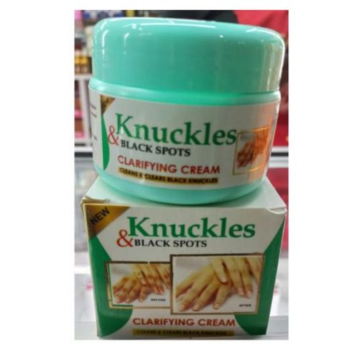 skin-beauty-knuckles-elbow-knee-toes-black-spot-cream