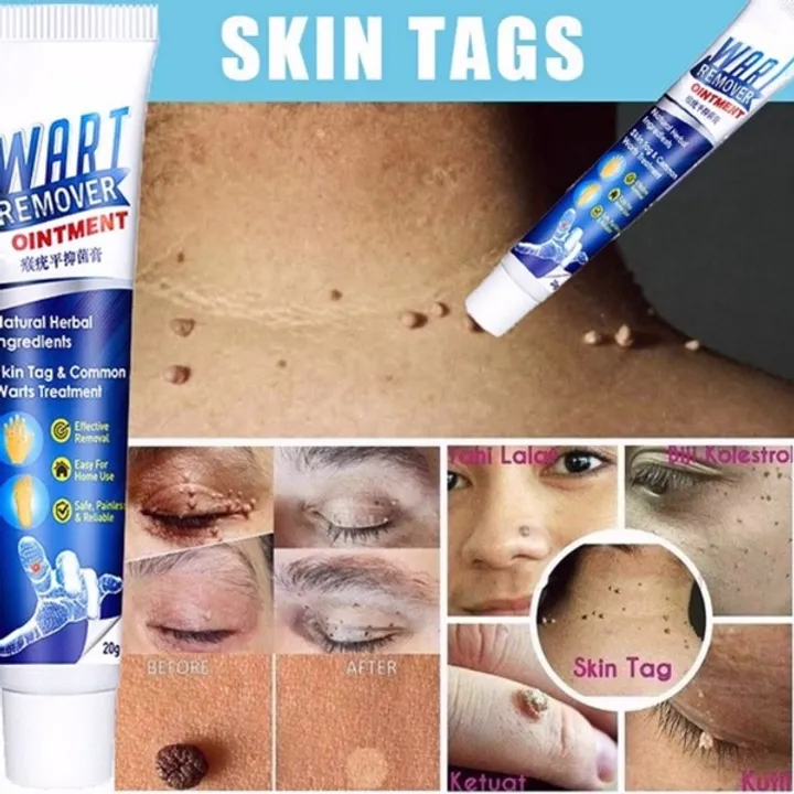 anti-crack-foot-cream-heel-cracked-repair-horse-oil-cream-smooth-removal-dead-skin-callus-anti-drying-hand-feet-skin-care-30g-30g-1