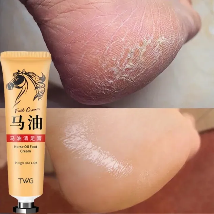 anti-crack-foot-cream-heel-cracked-repair-horse-oil-cream-smooth-removal-dead-skin-callus-anti-drying-hand-feet-skin-care-30g-30g