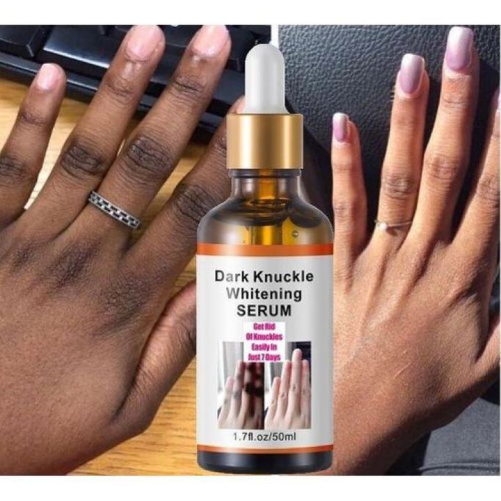 generic-knuckles-remover-whitening-serum-dark-spot-corrector-elbowsknees