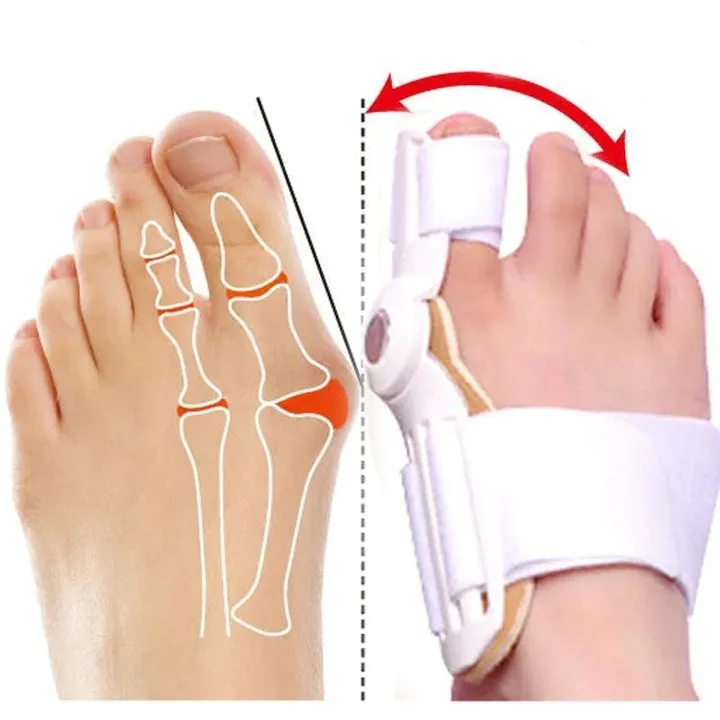 orthopedic-bunion-corrector-1-pcs-hallux-valgus-brace-splint-pads-bunion-big-toe-separators-straightener-universal-for-left-and-right-feet-white